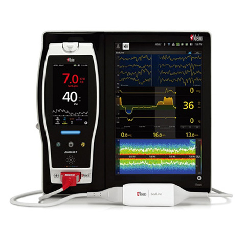 SsdLine大脑功能检测